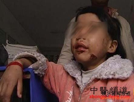 �����ͷ���Ů���� ���޲���·�˿�Ź